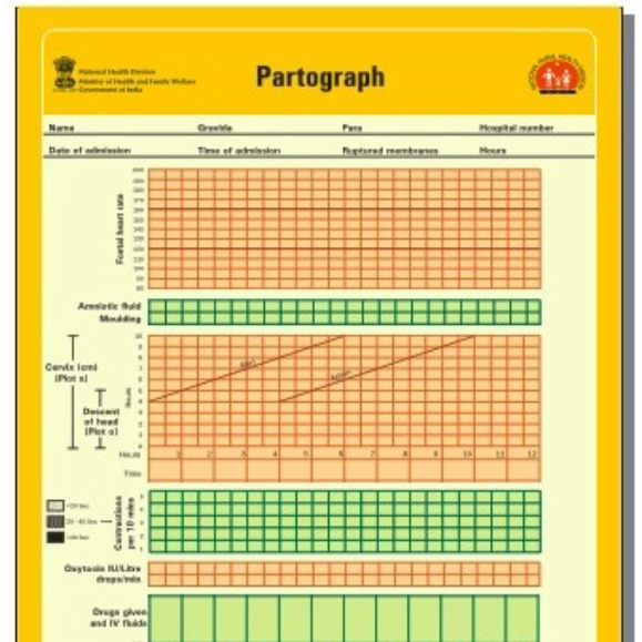 Partograph